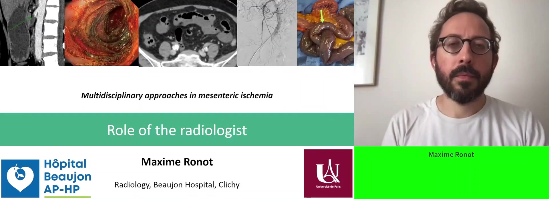 Multidisciplinary management: Role of the radiologist