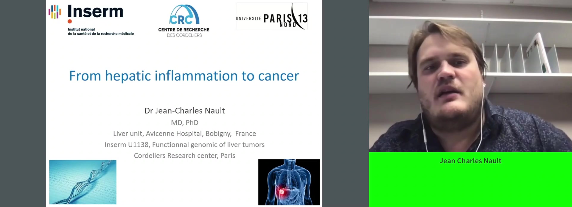 From hepatic inflammation to cancer