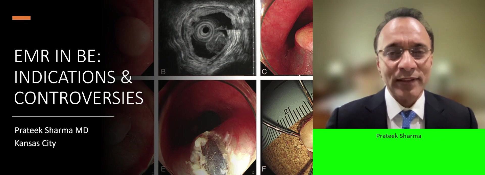 Endoscopic mucosal resection in Barrett: Indications and controversies
