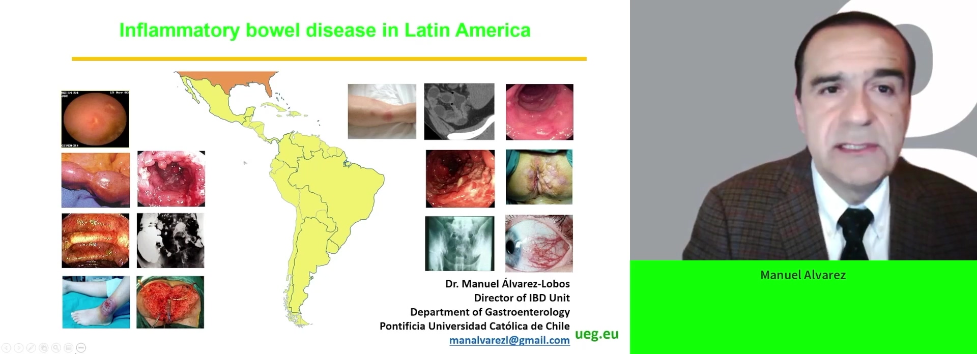Inflammatory bowel diseases in Latin America