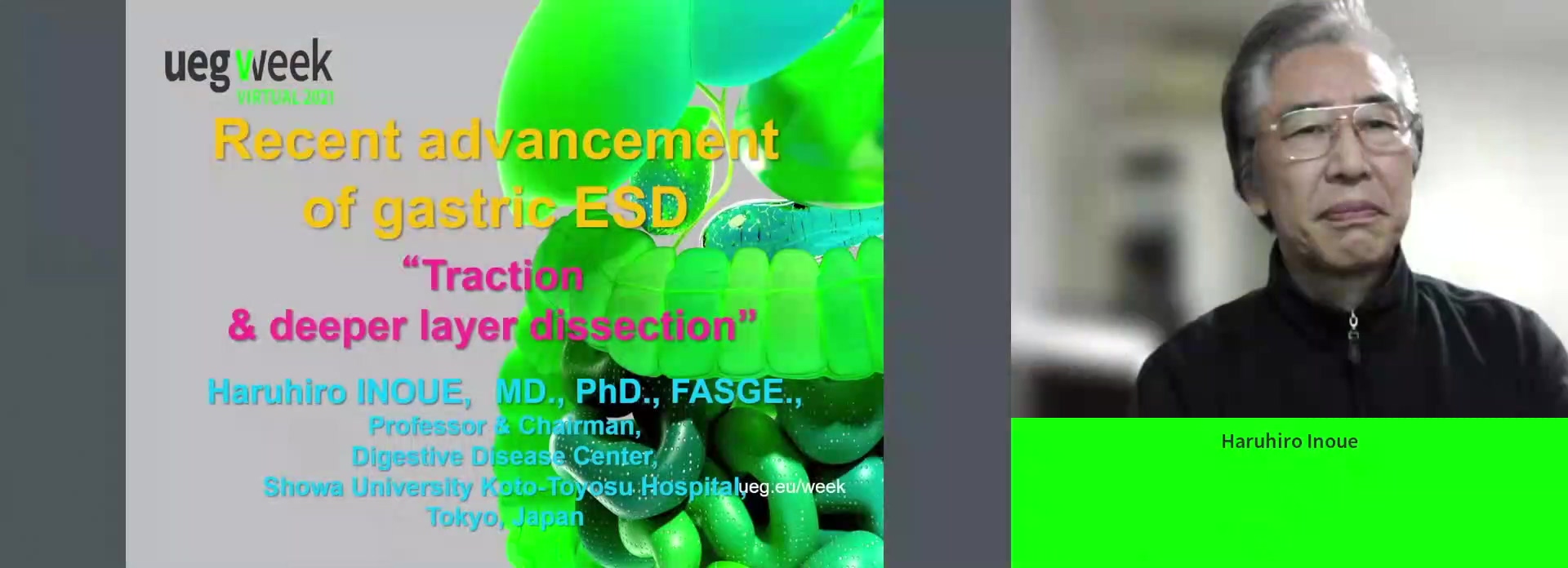 ESD for early gastric cancer