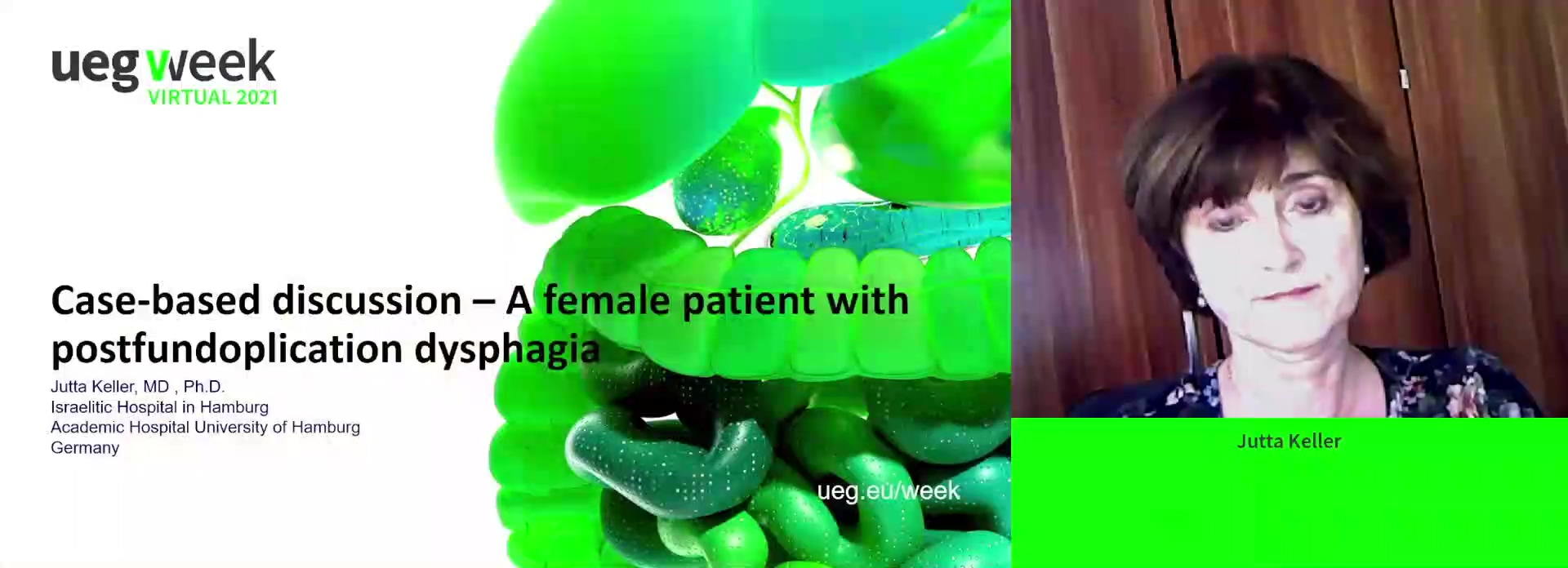 A female patient with post-fundoplication dysphagia