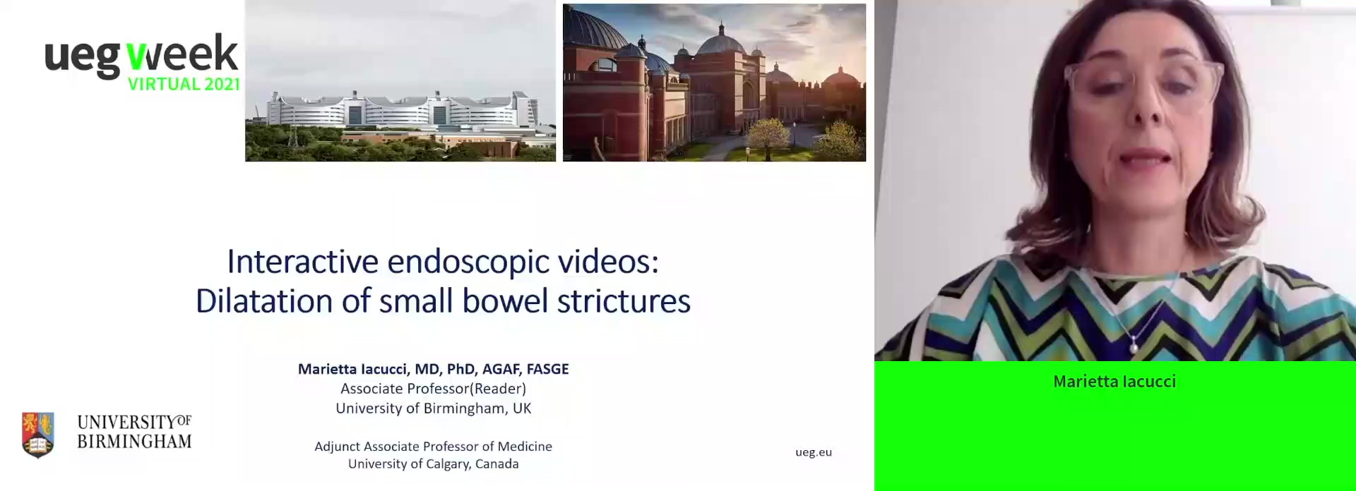 Interactive endoscopic videos: Dilatation of small bowel strictures
