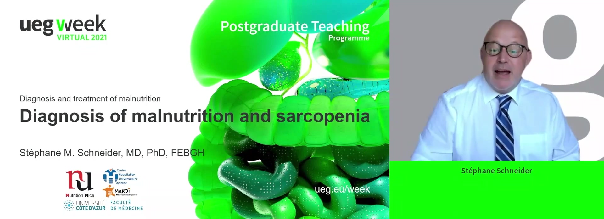 Diagnosis of malnutrition and sarcopenia